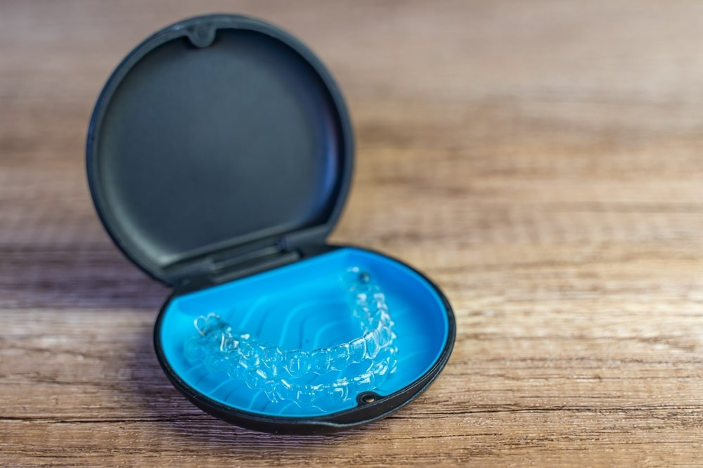 Invisalign Full o Lite: ¿cuáles son las diferencias?