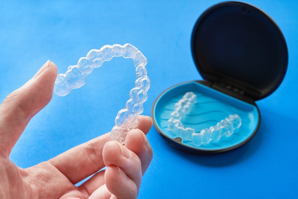 Invisalign Moderate: ¿qué es y en qué casos se utiliza?